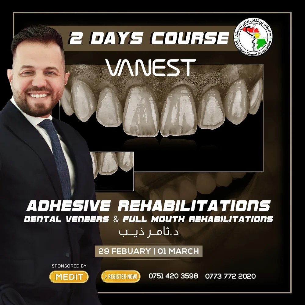 Dental Veneers And Full Mouth Rehabilitation